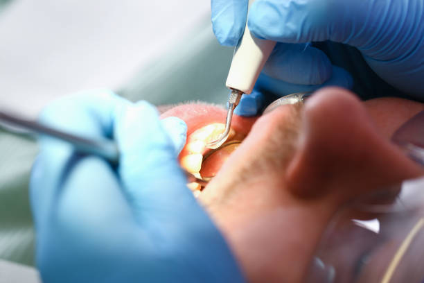 Best Broken or Chipped Tooth Repair in Ninety Six, SC